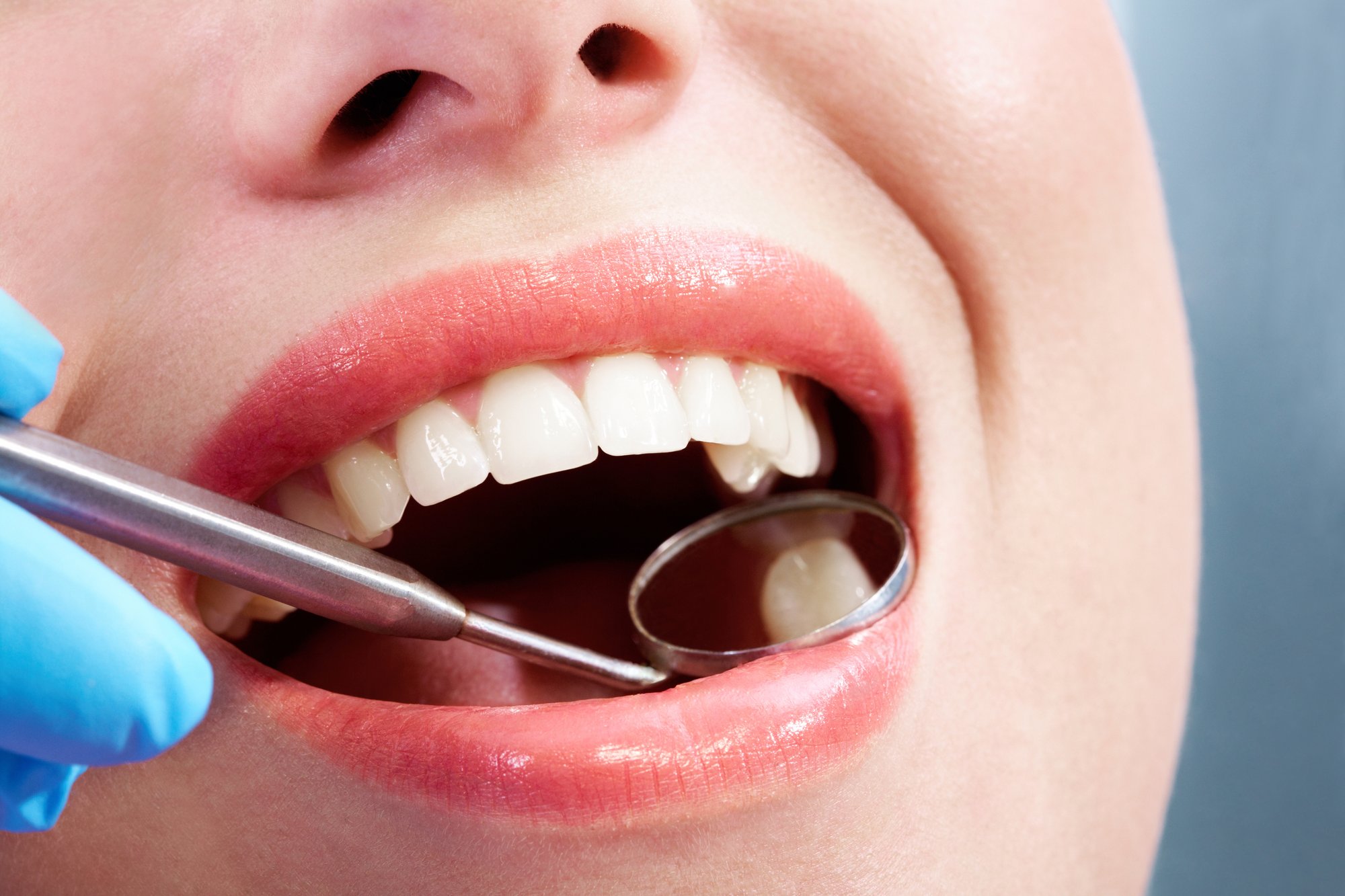 Do Dermal Fillers Hurt, and What Is Recovery Like?